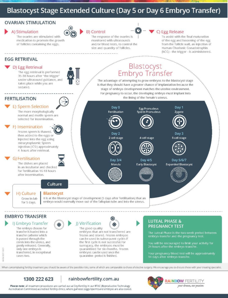 IVF Blastocyst Culture Infographic Rainbow Fertility