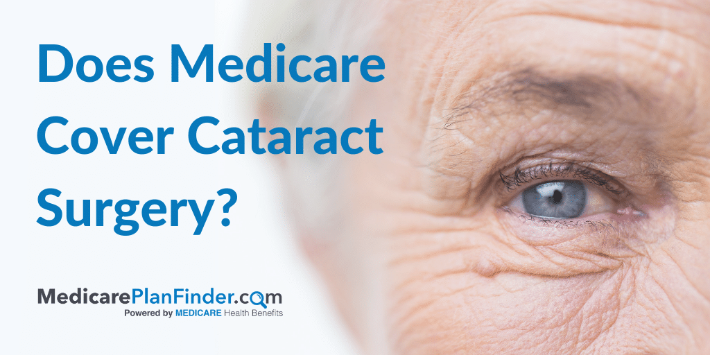 Does Medicare Cover Cataract Surgery 2020 Ultimate Guide 